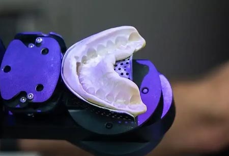 Advancing Clinical Consistency in Digital Dental Sleep Orthotics Advancing Clinical Consistency in Digital Dental Sleep Orthotics