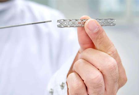Minimally Invasive Solutions: The Future of Brain Aneurysm Treatments Minimally Invasive Solutions: The Future of Brain Aneurysm Treatments